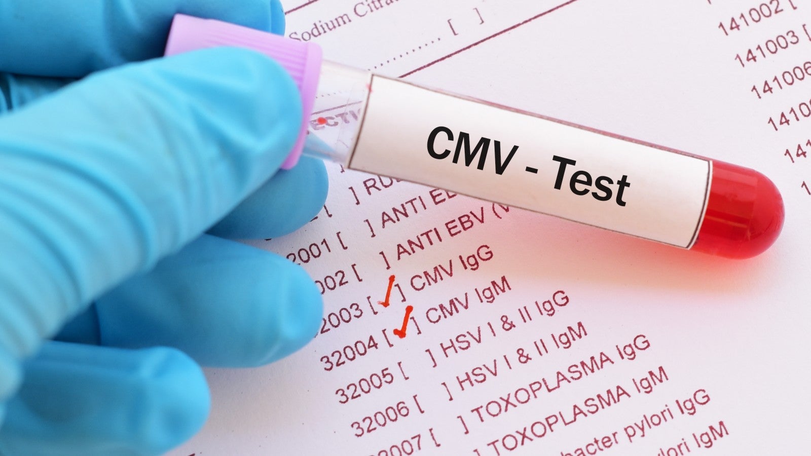 CMV test